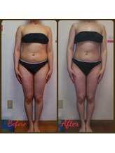 ダイエットルーム リ ボーヌ(Re Bornu)/・30代　全身メディセル8回