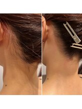 メローワックス 松本駅前店(MELLOW WAX)/うなじワックス脱毛