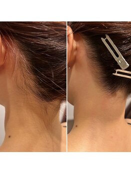 メローワックス 松本駅前店(MELLOW WAX)/うなじワックス脱毛