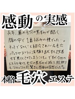 ルネッタ(Lunetta)/