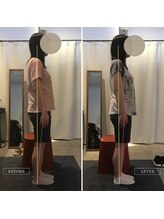 岡山整体 リソル(Resol)/ぽっこりお腹ビフォーアフター