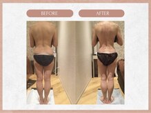 ソウイボディ 武蔵小杉店(Sou-i body)/お客様before→after