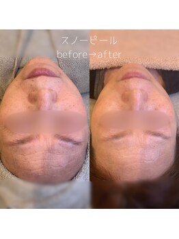 WA ネイル アンド ビューティー(WA nail & beauty)/ホワイトスノーピール