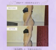 エステティック アントワネット