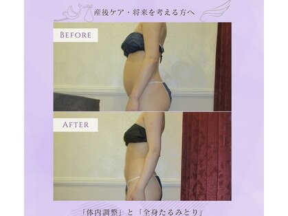 エステティック アントワネットの写真