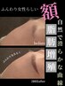 【立体小顔】脂肪増殖×リフトアップフェイシャル　120分　¥25,000→