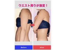 お客様にお喜び頂けたビフォーアフターの結果はフォトに掲載中