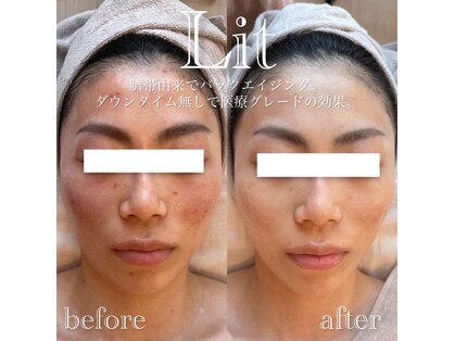 リノージュ(Linoju)の写真