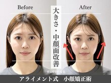 アライメント 自由が丘(Alignment)/大きさ・中顔面改善