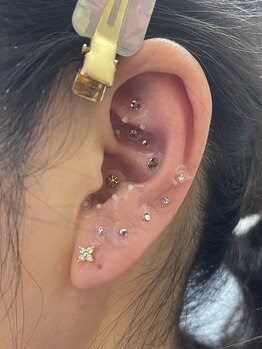 ラピス(Lapis)/耳つぼジュエリー施術例♪