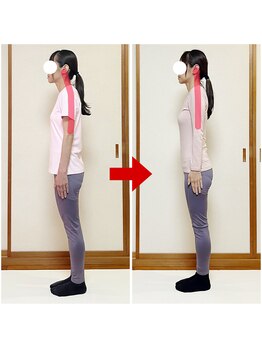 オステオデイジー(OsteoDaisy)/肩こり姿勢