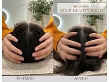 小顔×姿勢改善 KISHI BEAUTY SALON/【小顔矯正】