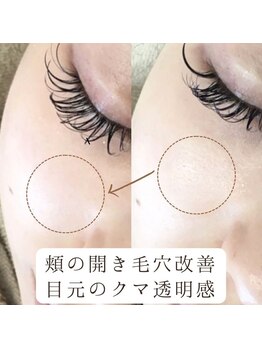 マヴィ くずは店(MavY.)/ハイドロジェリーマスク