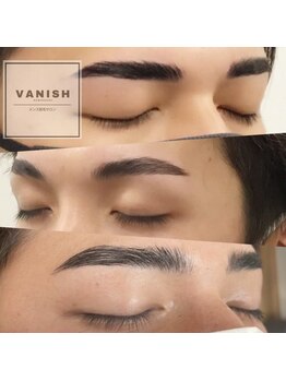 バニッシュ 川口店(VANISH)の写真/第一印象UP!新たな自分磨きに《眉毛&ヒゲ脱毛SET★アイブロウWAX&ヒゲ脱毛1回¥7880》お顔をまるっと整える!