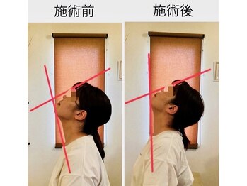 芦田整体療術院/首の可動域が変化!