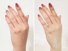 ネイル イコウ(nail ikou)の雰囲気（お砂糖のハンドスクラブで明るい印象のしっとり手肌を目指します）