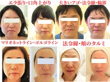 サロンドエステケイワイ(de KY)の雰囲気（小顔・タルミ改善法令線/エラ/二重顎/マリオネット/額シワ/歪み）