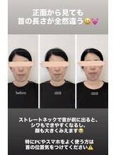 クロア ナゴヤ(Croire NAGOYA)/身体もやる小顔矯正♪