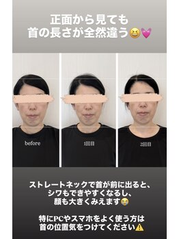 クロア ナゴヤ(Croire NAGOYA)/身体もやる小顔矯正♪