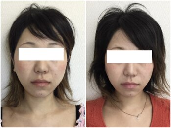 美容整体 ウェリナ 蟹江院/小顔矯正/骨盤矯正/美脚サロン