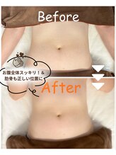 スリモア(SLIMORE)/ビフォーアフター☆お腹