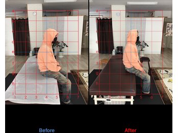 ストレチックス 近江八幡店/肩痛・姿勢改善ビフォーアフター