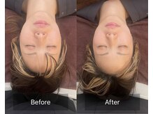 美身庵(Bishinan)/美身庵の小顔術