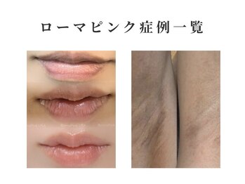 トータルビューティーアンドウィズ(total beauty&WITH)/ローマピンク