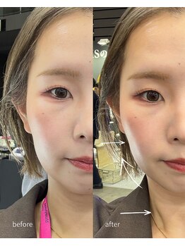 オニュ(onyu)/小顔になりたい方集合！