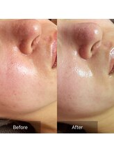 ヒール(heal)/水エステ