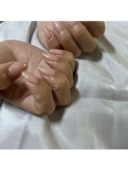 オーロラフレンチ