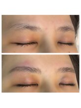 アンク(AnnC)/ハリウッドブロウリフト