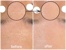 毛穴専科/毛穴洗浄+白玉ワックス メンズ◎