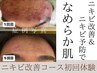 【ニキビケア】ハーブピーリング使用で赤み改善＆肌デトックス！角質肥厚に◎