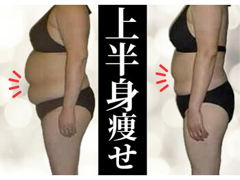 ルーミー(LUME.)/痩身モニター様比較写真