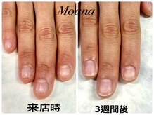 モアナ 池袋(MOANA)/３週間で激変