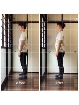 ミントのかべの整体院/ビフォーアフター