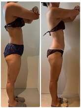 エムグラッティチュード(M gratitude)/60分リンパマッサージ