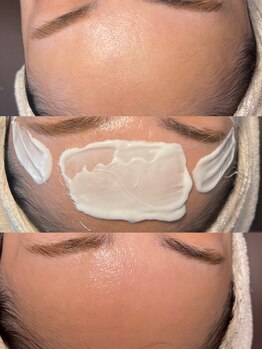 顔脱毛がしたい