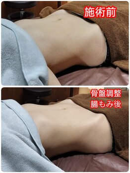 シャルールプラス(chaleurplus)/ブライダル前に。。。