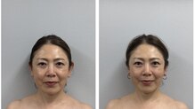 トゥルーカラーズ