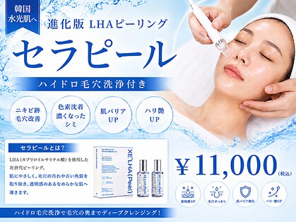 ジーン(Gene)の写真