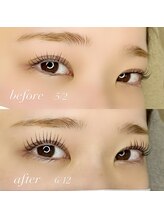 アトラ(Attra)/ラッシュアディクト