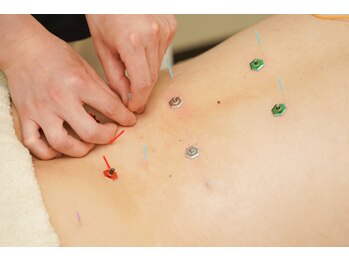 桂東洋鍼灸整骨院/鍼灸