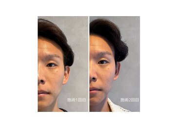 ミトノウ(MITONOU)/お客様ビフォーアフター