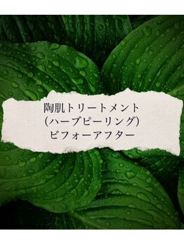 ブラックボックス(BLACK BOX)/