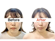 ウニカ(Unica)/BeforeAfter