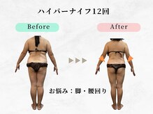 美容整体ウェリナ 中川八田院/小顔矯正/骨盤矯正/痩身整体