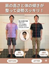 のなか整体院/整体 Before→After