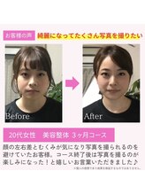 えのもと美容整体院/顔の歪み、むくみ、たるみ改善